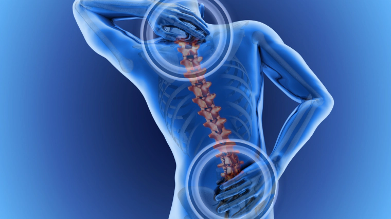 Pulled Back Muscle Treatment